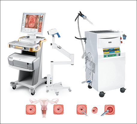 Thiết bị điều trị viêm tuyến lộ tử cung băng dao LEEP